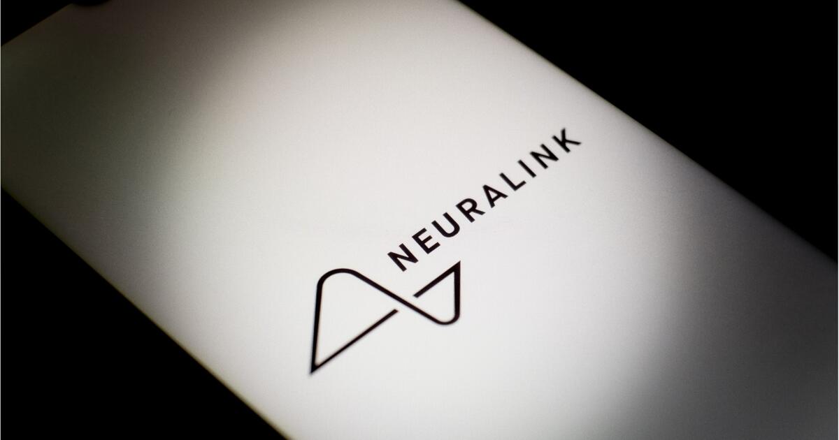 Neuralink Elon Musks Start Up Implantiert Erstmals Gehirnchip