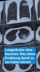 Warum immer mehr Nichtraucher an Lungenkrebs erkranken