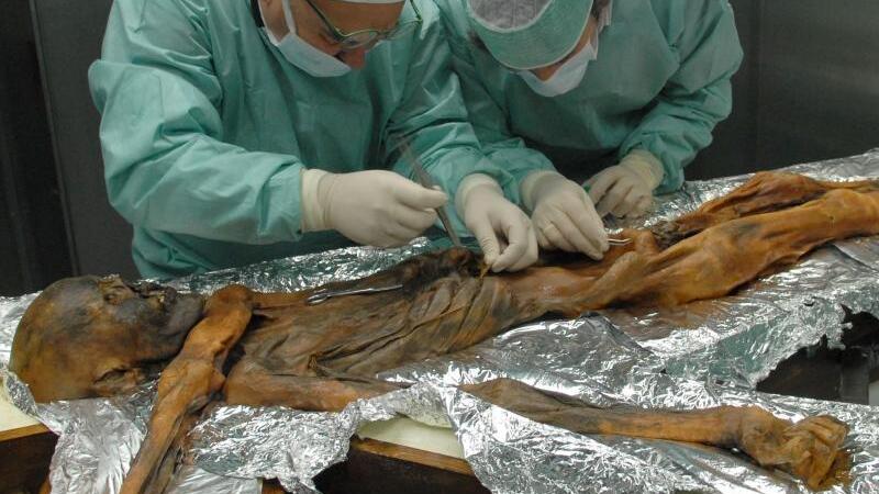 Ötzi auf dem Seziertisch