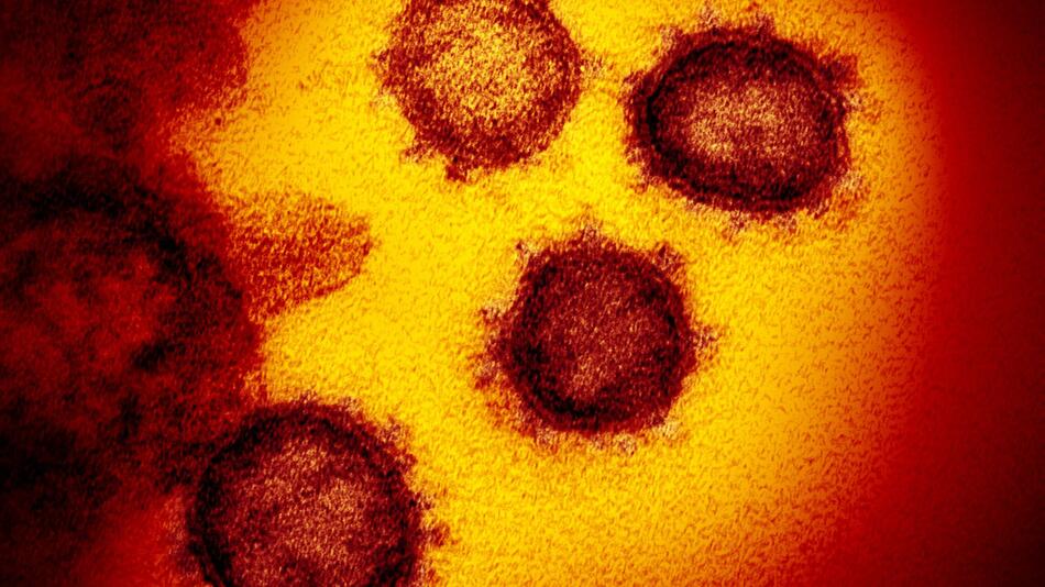 Coronavirus SARS-CoV-2