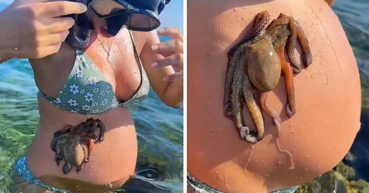 Meeresbewohner am Bauch: Schwangere erlebt Überraschung - Video | 1&1
