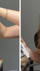 Keinen Korkenzieher zur Hand? Glätteisen öffnet Weinflasche
