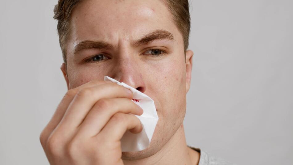 Ein junger Mann versucht, sein Nasenbluten zu stoppen