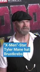"X-Men"-Star Tyler Mane hat Brustkrebs