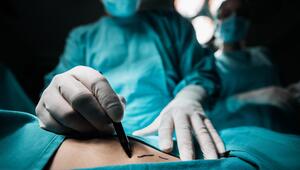 Los Deline, Aquafilling, Filler, Schönheitseingriff, Beautyeingriff, Schönheitschirurgie