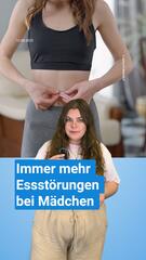 Essstörungen bei jungen Mädchen: Zahl der Klinikbehandlungen in 20 Jahren verdoppelt
