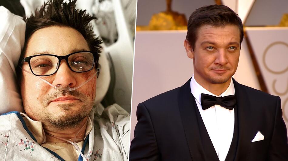 Brustkorb kollabiert: So schwer war der Unfall von Marvel-Star Jeremy Renner