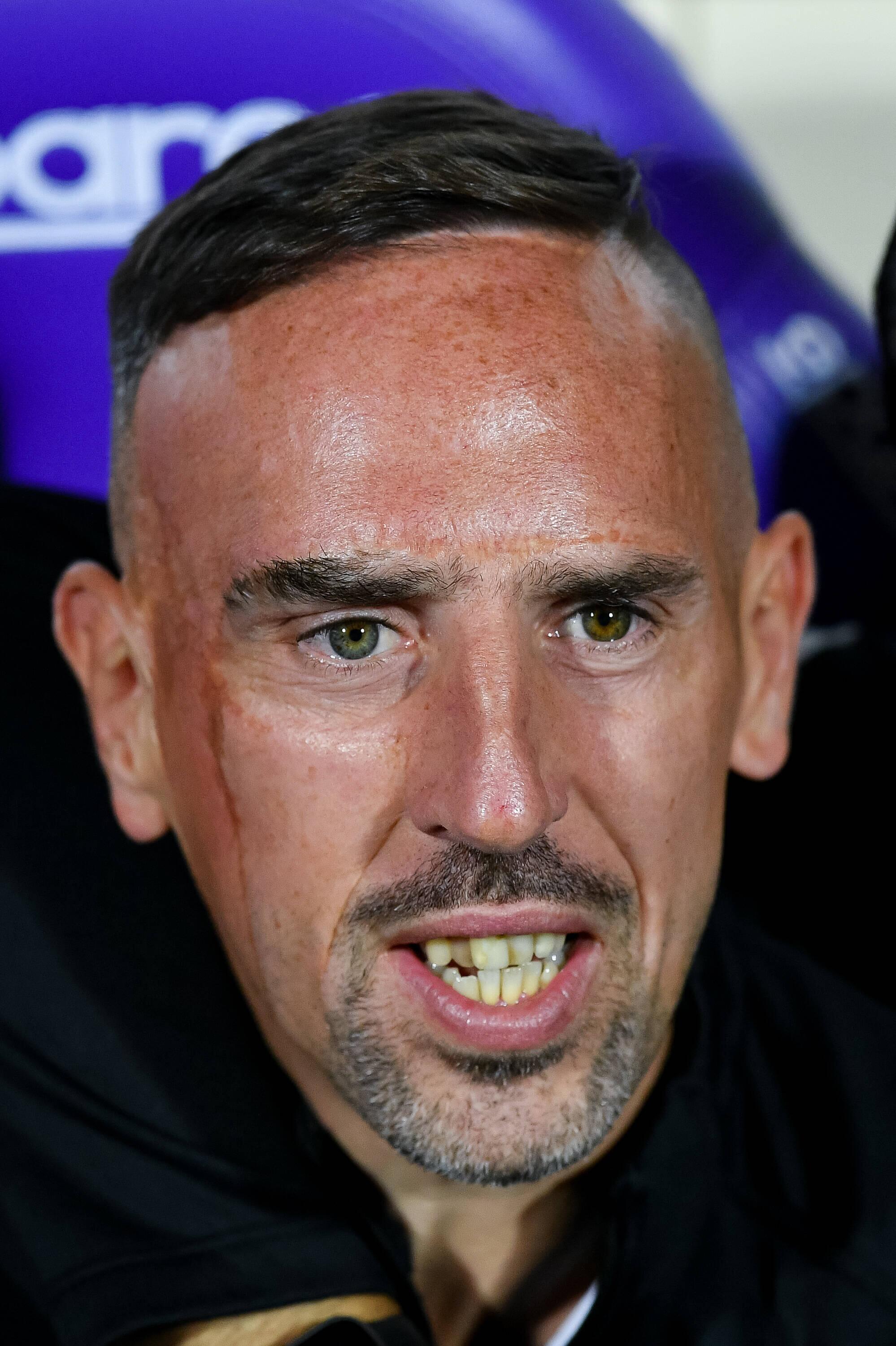 Frank Rippery Antwort Was hat Frank Ribéry im Gesicht gemacht? Weitere Antworten ...