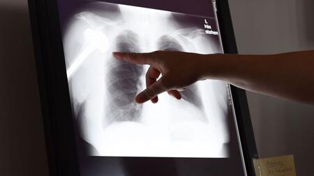 Verdacht auf Behandlungsfehler? Das können Sie nun tun