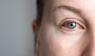 Frau mit gerötetem Auge