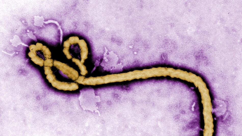 Ebola-Virus